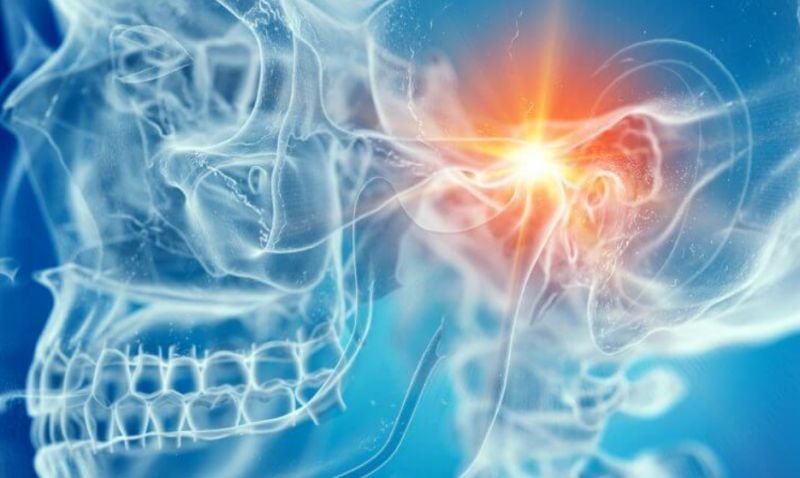 How Can Physiotherapy Relieve TMJ Pain?